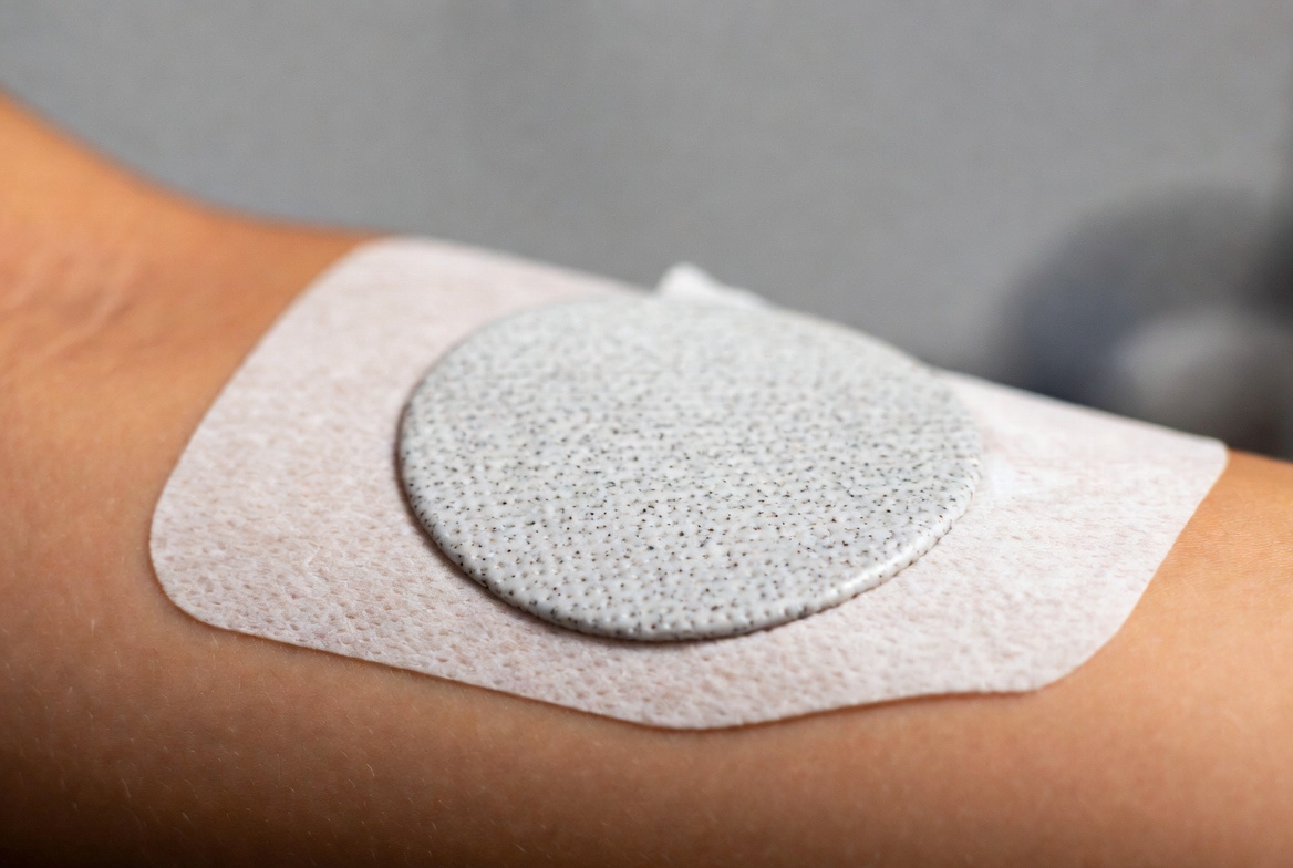 Tout savoir sur l'immunothérapie épicutanée